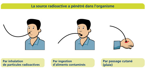 Trois modes d'exposition interne.