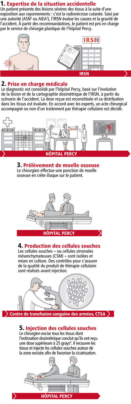 Des cellules souches pour traiter des brûlures radiologiques