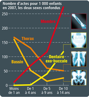 Quelques examens de radiologie conventionnelle.©Hervé Bouilly - Source rapport Expri/IRSN