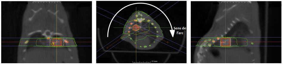 planification d’un traitement et ses isodoses pour un traitement en Arc avec le collimateur de 3 x 3 mm².