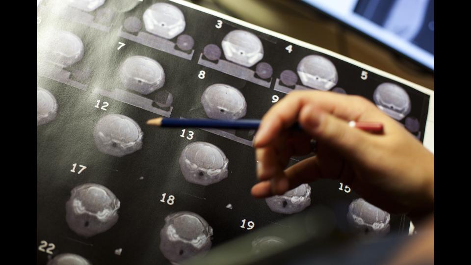superposition d'images scanner acquises à l'aide du SARRP et d'images IRM acquises sur une plateforme externe. (c) Médiathèque IRSN / Francesco Acerbis